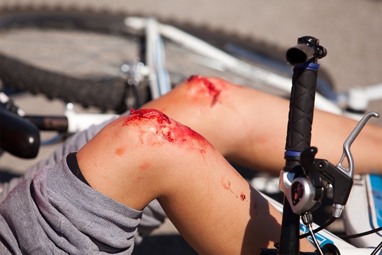 Vážné nehody cyklistů na Frýdecko-Místecku a Bruntálsku