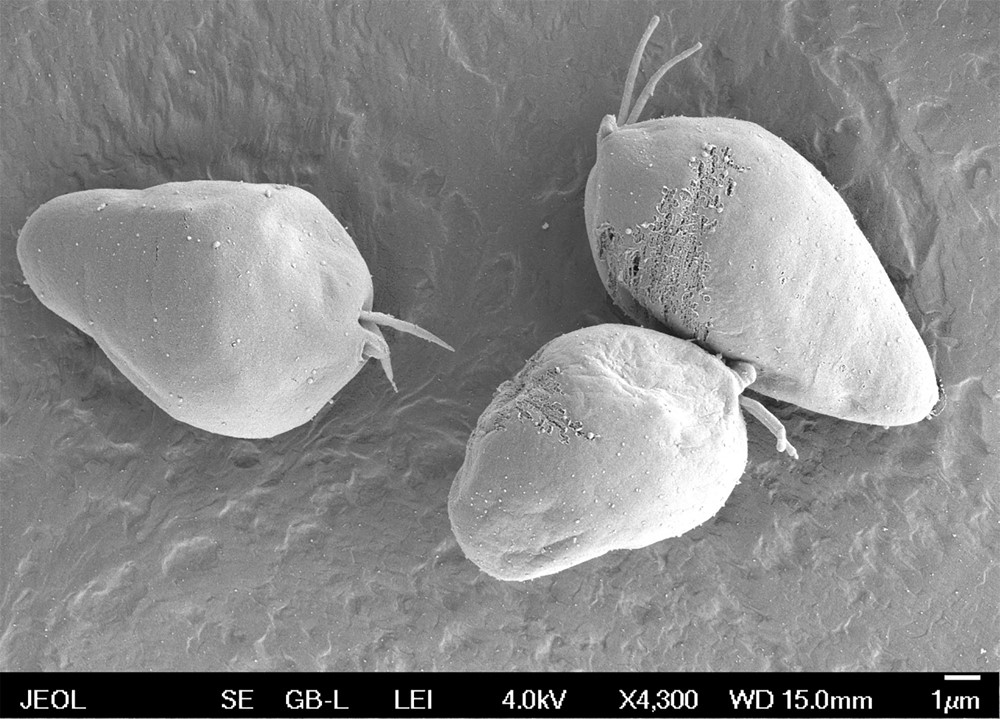 Snímek ze skenovacího elektronového mikroskopu: Diplonema papillatum je mořský prvok s dvěma bičíky.